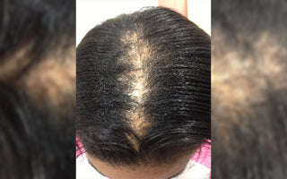 Prevent Hair Loss with Black Hair Women